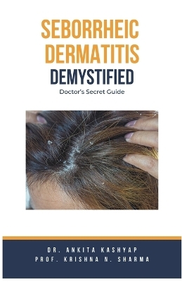 Seborrheic Dermatitis Demystified - Dr Ankita Kashyap, Prof Krishna N Sharma