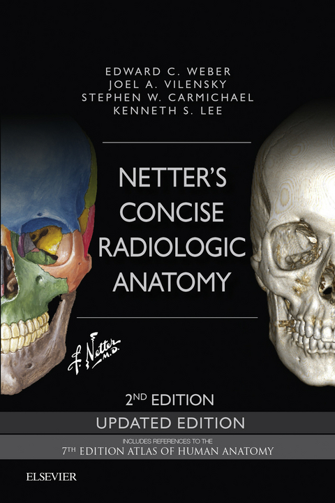 Netter's Concise Radiologic Anatomy Updated Edition -  Stephen W. Carmichael,  Joel A. Vilensky,  Edward C. Weber