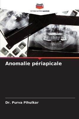 Anomalie périapicale - Dr Purva Pihulkar