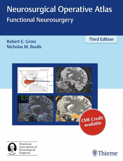 Neurosurgical Operative Atlas - 