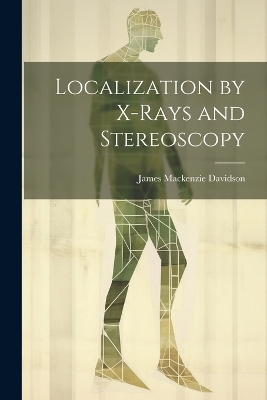Localization by X-Rays and Stereoscopy - James Mackenzie Davidson