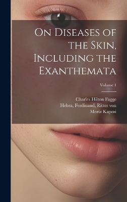 On Diseases of the Skin, Including the Exanthemata; Volume 1 - Charles Hilton 1838-1883 Fagge