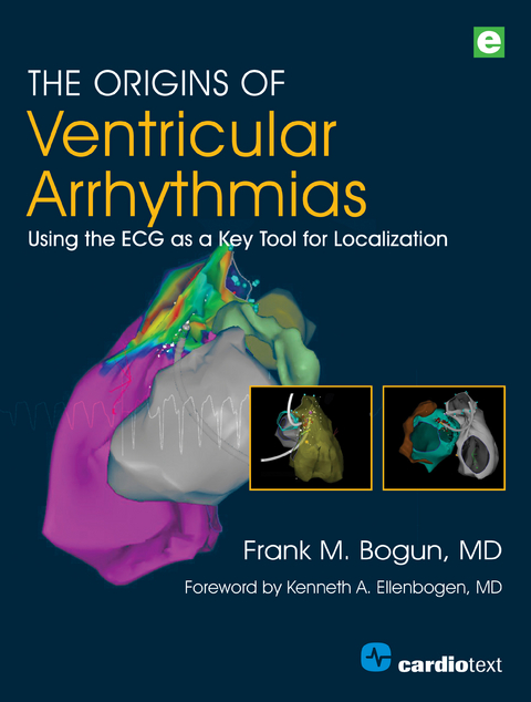 Origins of Ventricular Arrhythmias -  Frank M. Bogun MD