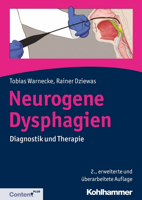 Neurogene Dysphagien - Tobias Warnecke, Rainer Dziewas