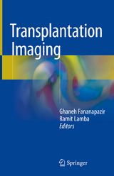 Transplantation Imaging - 