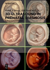 3D Ultrasound in Prenatal Diagnosis - Rabih Chaoui, Kai-Sven Heling