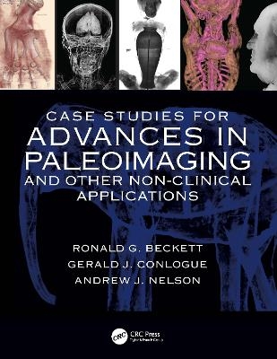 Case Studies for Advances in Paleoimaging and Other Non-Clinical Applications - Ronald G. Beckett, Gerald J. Conlogue, Andrew Nelson