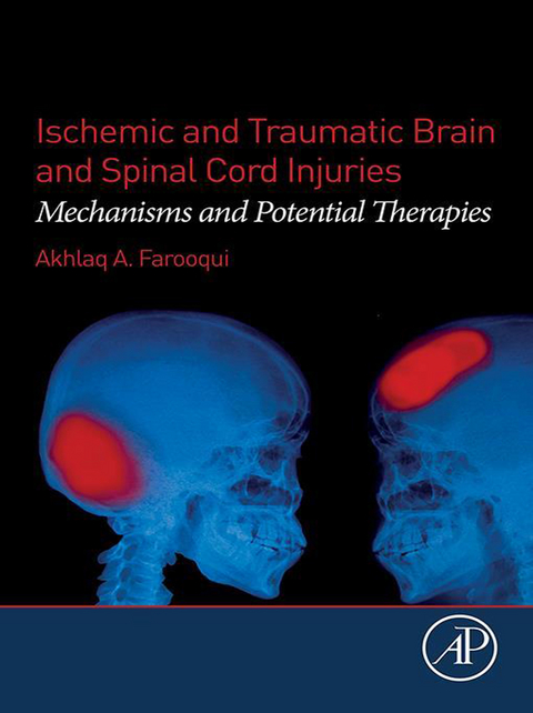 Ischemic and Traumatic Brain and Spinal Cord Injuries -  Akhlaq A. Farooqui