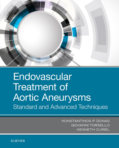 Endovascular Treatment of Aortic Aneurysms -  Konstantinos P. Donas,  Ken Ouriel,  Giovanni Torsello