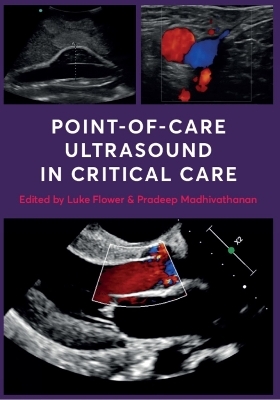 Point-of-Care Ultrasound in Critical Care - 
