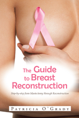 Guide to Breast Reconstruction -  Patricia O'Grady