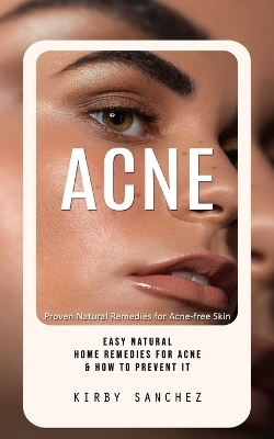 Acne - Kirby Sanchez