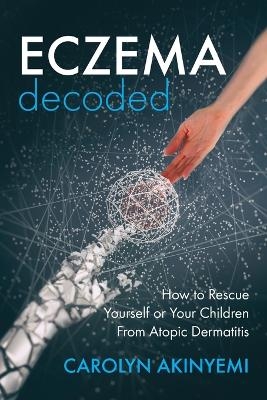 Eczema Decoded - Carolyn Akinyemi