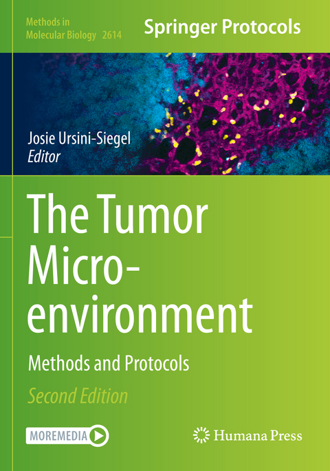 The Tumor Microenvironment - 