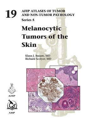 Melanocytic Tumors of the Skin - Klaus J. Busam, Richard Scolyer, Kara Taylor