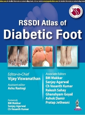 RSSDI Atlas of Diabetic Foot - Vijay Viswanathan, Ashu Rastogi