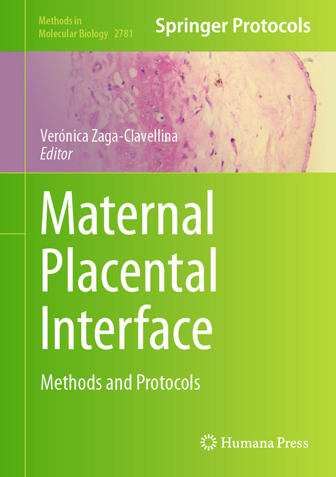 Maternal Placental Interface - 