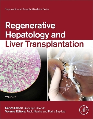 Regenerative Hepatology and Liver Transplantation - 