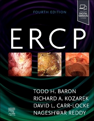 ERCP - 