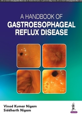 A Handbook of Gastroesophageal Reflux Disease (GERD) - Vinod Kumar Nigam, Siddharth Nigam