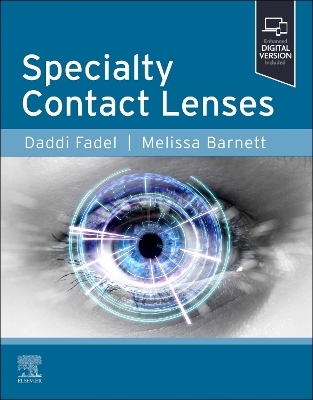 Specialty Contact Lenses - 