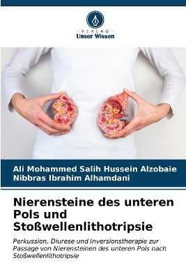 Nierensteine des unteren Pols und Stoßwellenlithotripsie - Ali Mohammed Salih Hussein Alzobaie, Nibbras Ibrahim Alhamdani