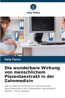 Die wunderbare Wirkung von menschlichem Plazentaextrakt in der Zahnmedizin - Hala Fares