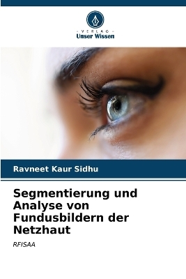 Segmentierung und Analyse von Fundusbildern der Netzhaut - Ravneet Kaur Sidhu