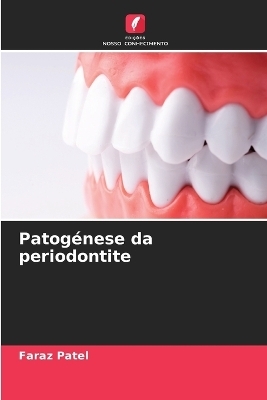 Patogénese da periodontite - Faraz Patel