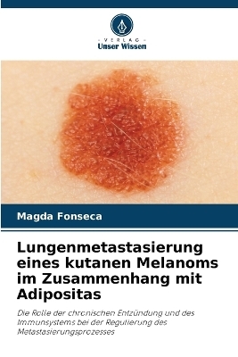 Lungenmetastasierung eines kutanen Melanoms im Zusammenhang mit Adipositas - Magda Fonseca