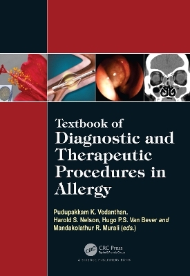 Textbook of Diagnostic and Therapeutic Procedures in Allergy - 