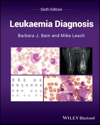 Leukaemia Diagnosis - Barbara J. Bain, Mike Leach