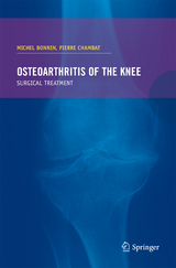 Osteoarthritis of the knee - 