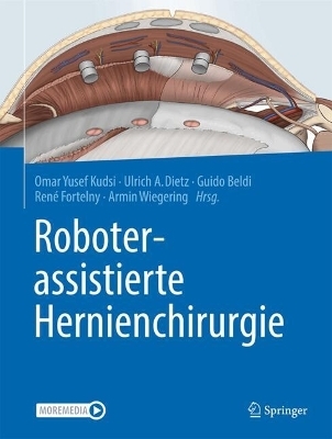 Roboterassistierte Hernienchirurgie - 