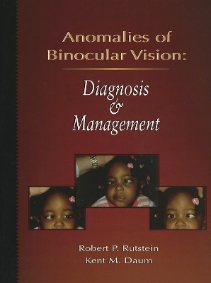 Anomalies Of Binocular Vision - Robert P. Rutstein, Kent M. Daum