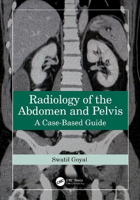 Radiology of the Abdomen and Pelvis - Swati Goyal