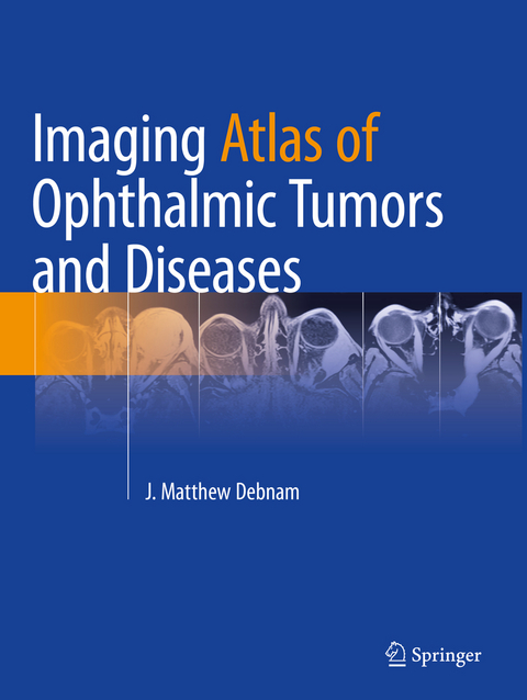 Imaging Atlas of Ophthalmic Tumors and Diseases - 