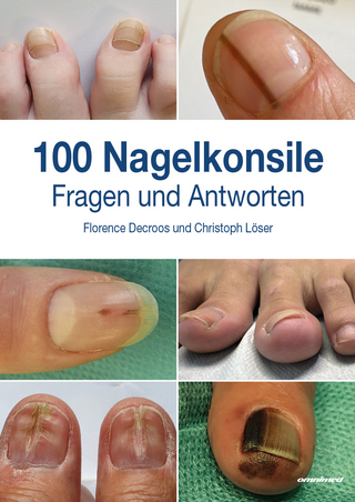 100 Nagelkonsile - Christoph Löser; Florence Decroos