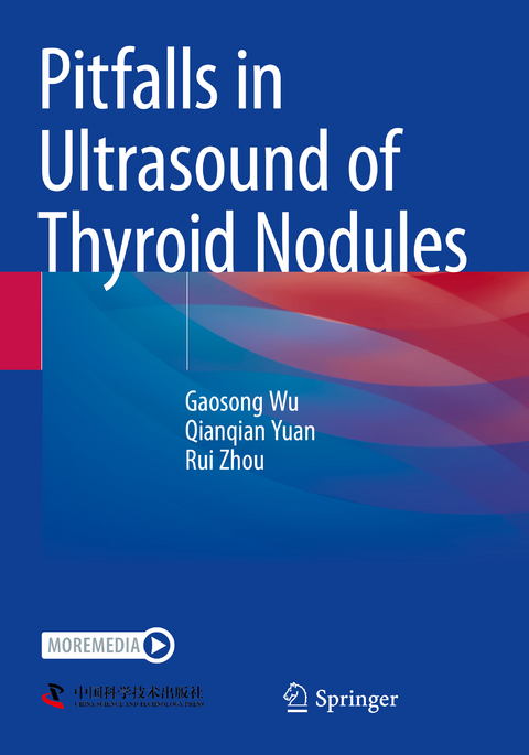Pitfalls in Ultrasound of Thyroid Nodules - Gaosong Wu, Qianqian Yuan, Rui Zhou