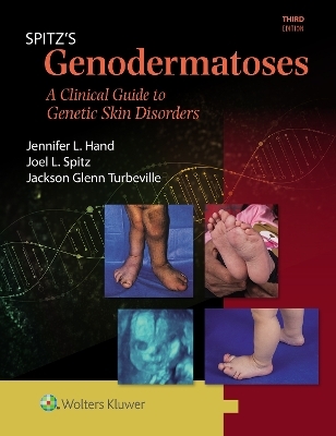 Spitz's Genodermatoses - Joel L. Spitz, Jennifer Lynn Hand, Jackson Glenn Turbeville