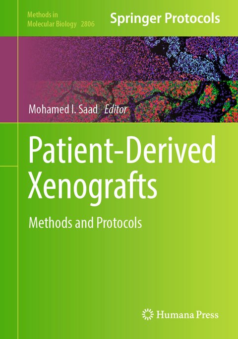 Patient-Derived Xenografts - 