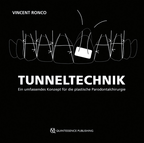 Tunneltechnik - Vincent Ronco