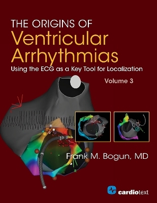 The Origins of Ventricular Arrhythmias, Volume 3 - Frank Bogun