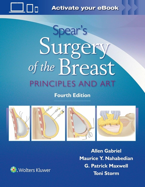 Spear's Surgery of the Breast - 
