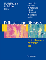 Diffuse Lung Diseases - 