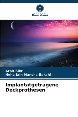 Implantatgetragene Deckprothesen - Arpit Sikri, Neha Jain Mansha Bakshi