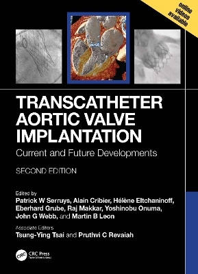 Transcatheter Aortic Valve Implantation - 