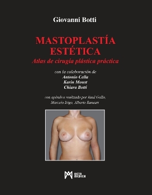 Mastoplastía Estética - Giovanni Botti, Antonio Cella, Karin Moust, Chiara Botti