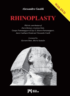 Rhinoplasty - Alessandro Gualdi