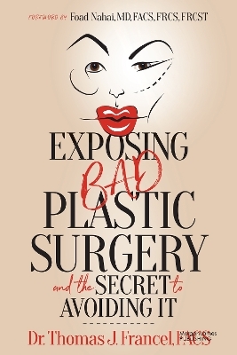 Exposing Bad Plastic Surgery - Dr. Thomas J. Francel